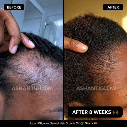 Natural Hair Growth Oil — Regrow Your Edges in 30 Days
